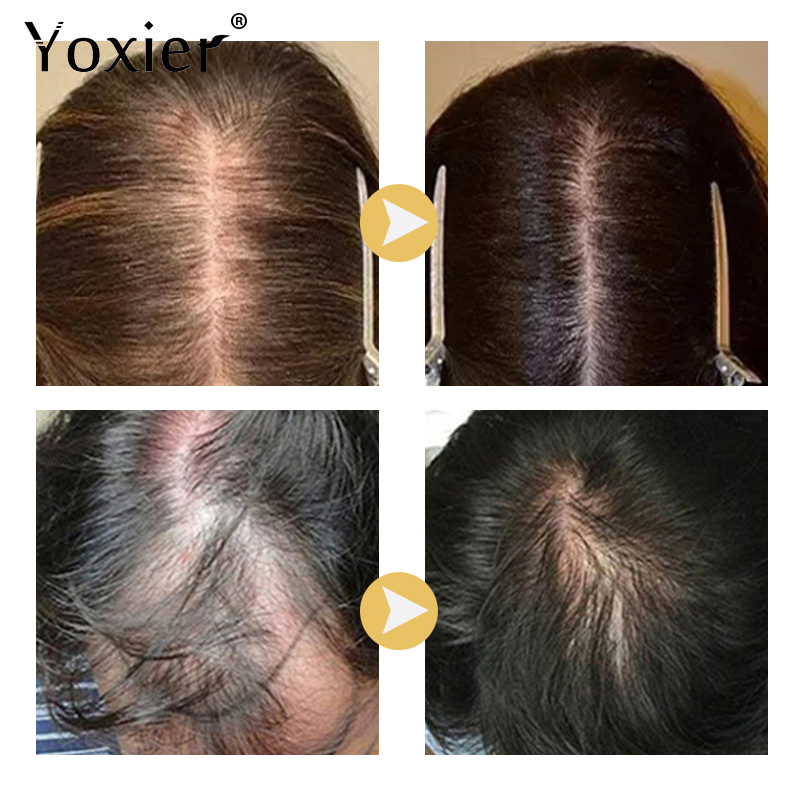 Intensywne Serum wzrostu zapob – Hair Care Treatment recenzja i cena