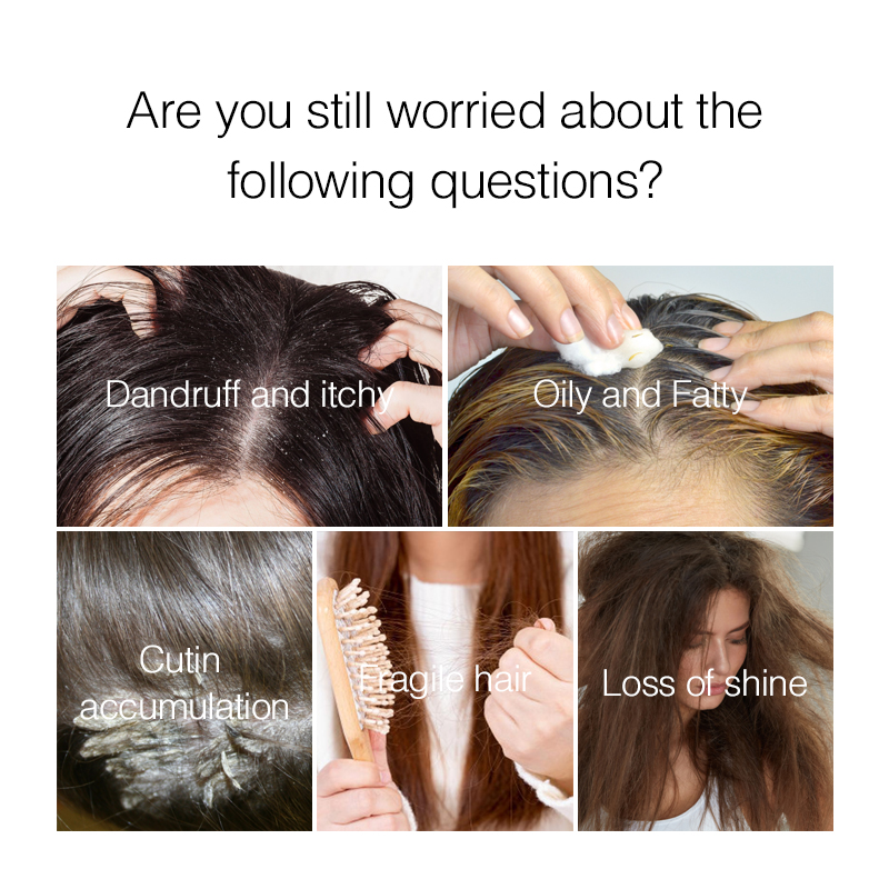 PURC Hair Scalp Treatment Esse – Hair Care Normal recenzja i cena