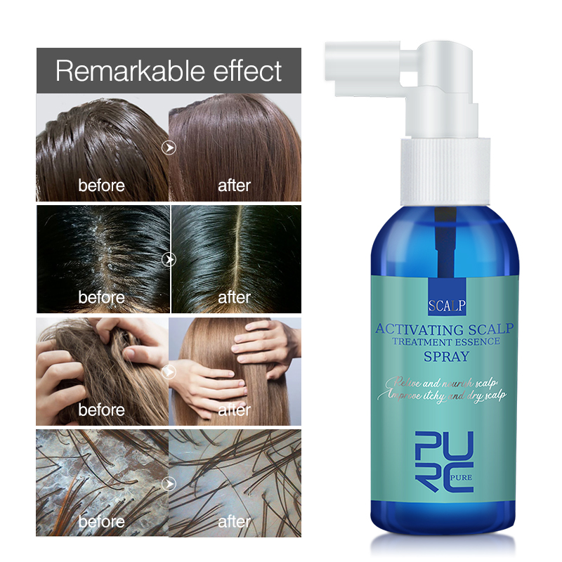 PURC Hair Scalp Treatment Esse – Hair Care Normal recenzja i cena